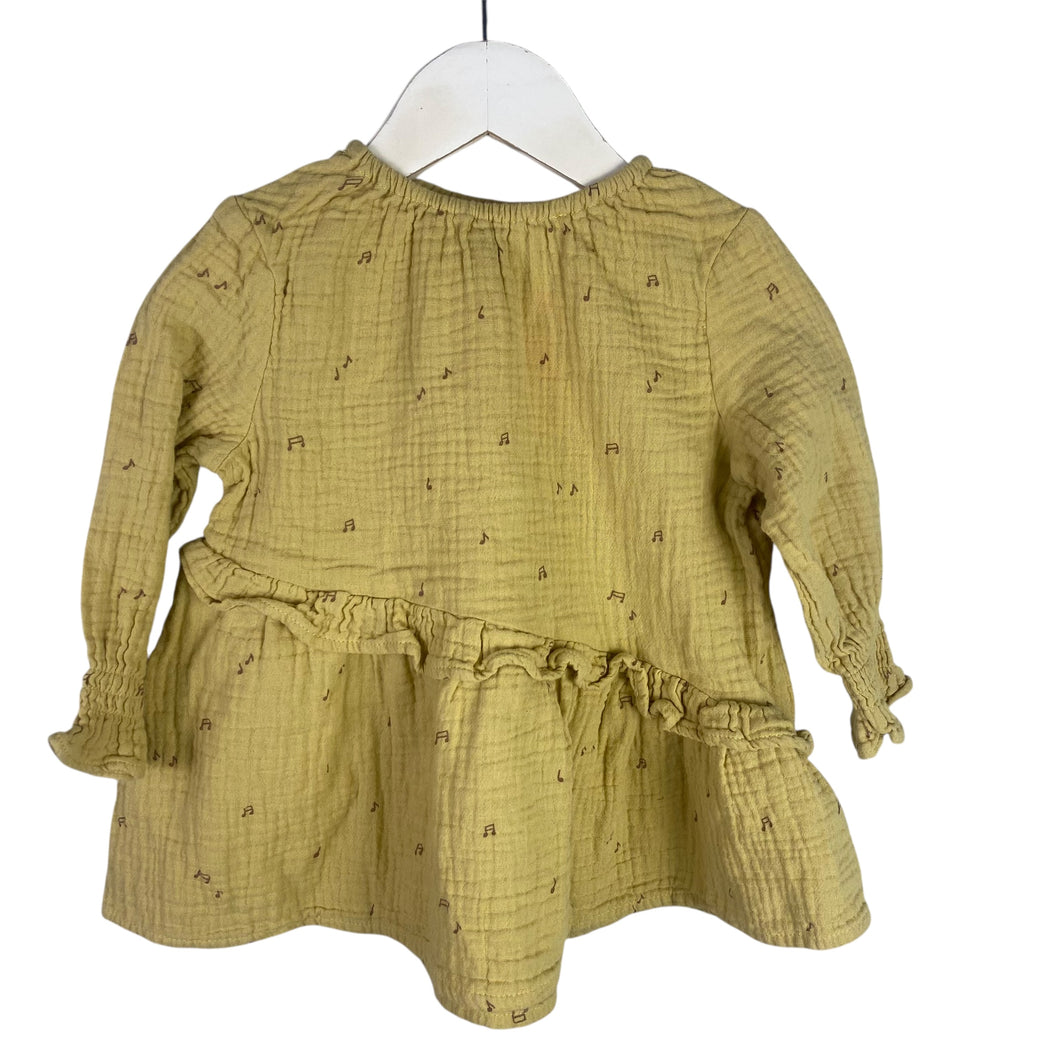 Rylee and cru Tunic size 12–18 months